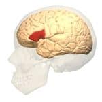 Aphasia